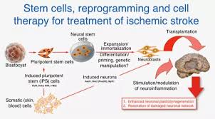 Regenerative Cell Therapy